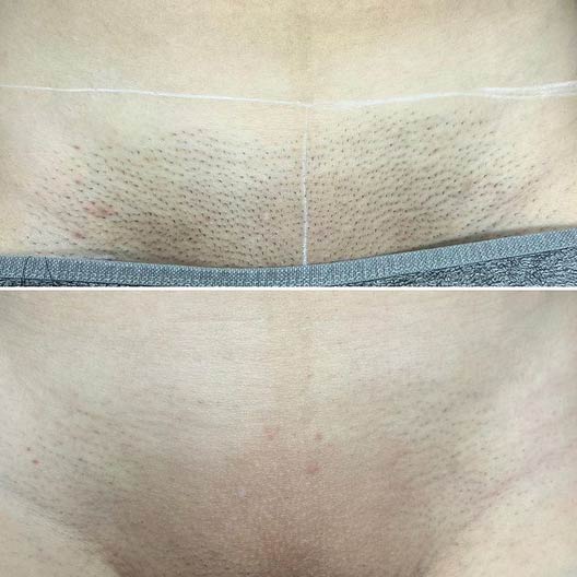 Before-After-Eneka-01