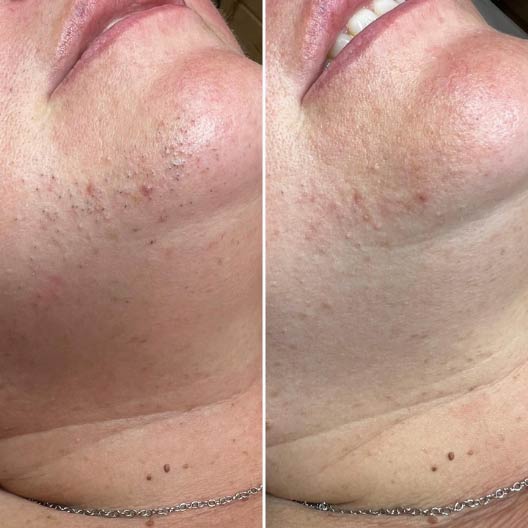 Before-After-Eneka-03