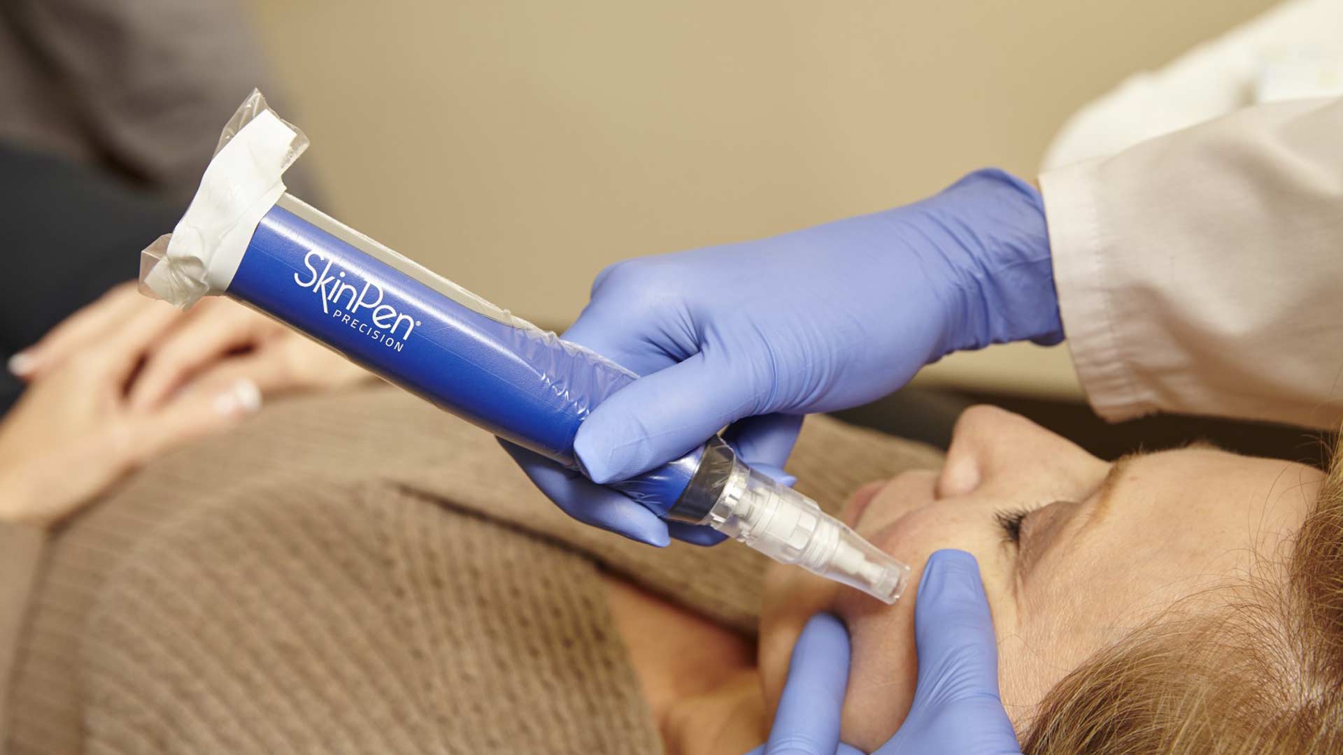 SkinPen-Top